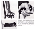 Armstockstütze für Gehbehinderte, Artikel (form, 32/Dez.1965), Teil 3